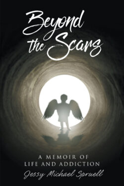 Beyond the Scars A Memoir of Life and Addiction