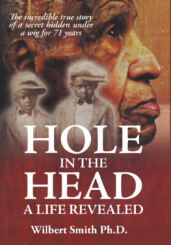 Hole in the Head: A Life Revealed